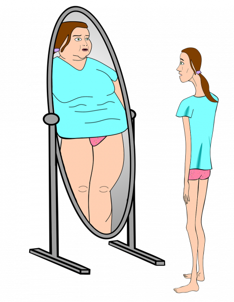 L'obésité, l'anorexie : les symptômes et les moyens de retrouver un équilibre alimentaire